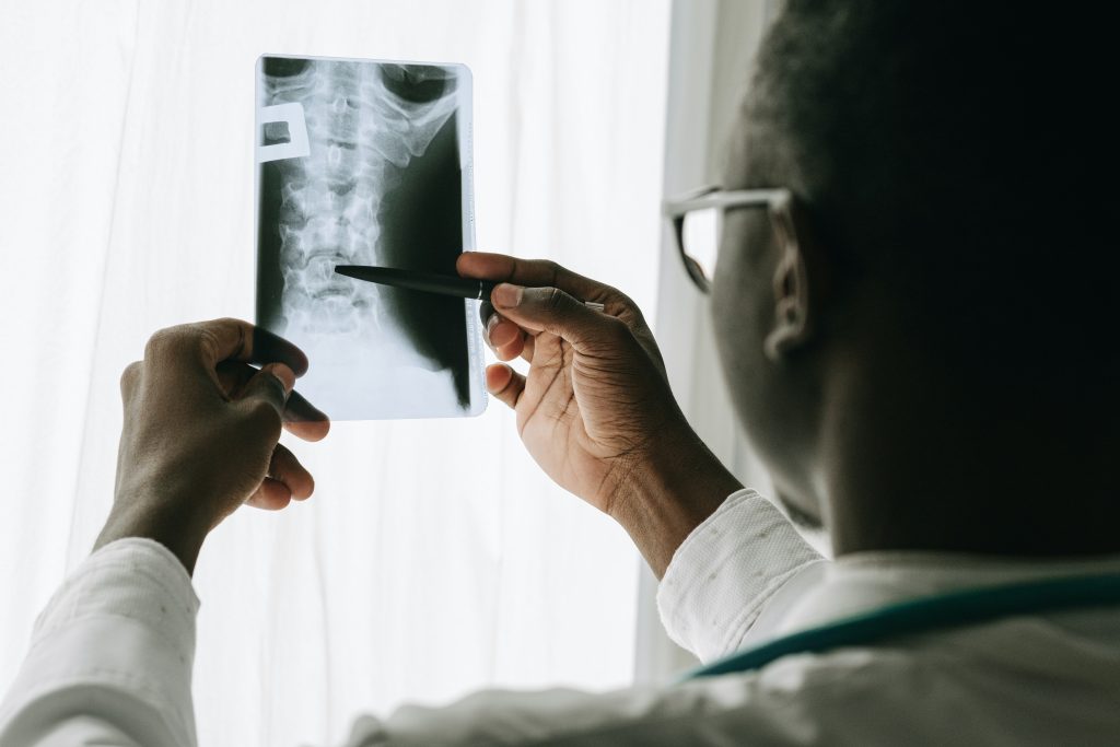 Doctor holds an X-Ray photo up to light while examining it.